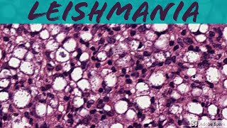 Leishmaniasis: 5-Minute Pathology Pearls screenshot 3