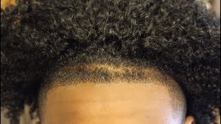 Mens Straight Hairline Tutorial