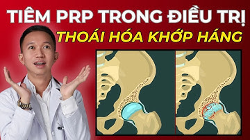 Những ưu điểm của Tiêm PRP trong thoái hóa khớp háng  | Bác Sĩ Trần Minh