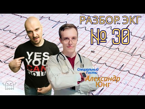 Видео: Разбор ЭКГ № 30