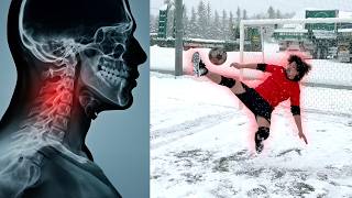 オーバーヘッドしたら着地ミスって大ケガしました。