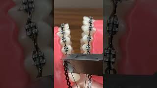 BEHEL GIGI PAKAI KARET POWER CHAIN SAMBUNG - Braces Ortho Dental Kawat Orthodontik Orthodontic