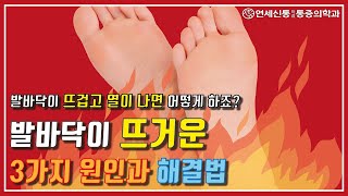 발바닥이 뜨거운/발이 화끈거리는 증상, 3가지 원인과 해결법(AKA 발에 열나는 족심열)