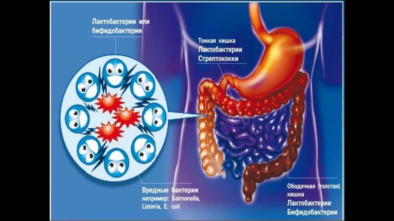 микробиота кишечника. кишечный дисбактериоз. кишечный дисбактериоз. кишечный дисбактериоз. клинические проявления дисбактериоза кишечника.