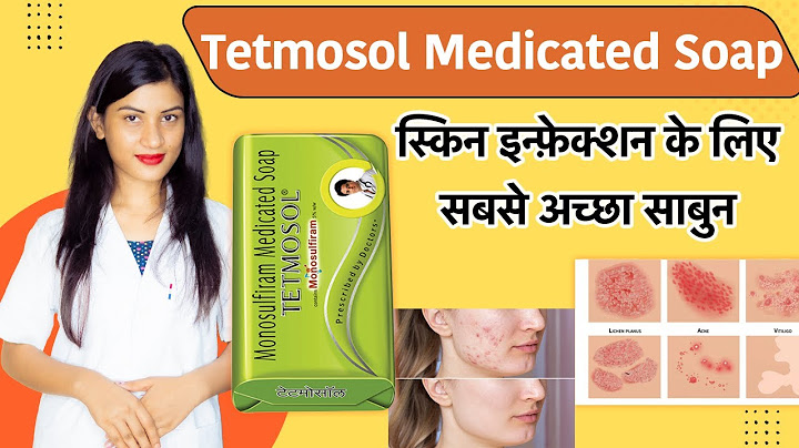 Tetmosol Soap Use in Face | Tetmosol Soap | Skin Infections | Tetmosol Sabun | Fayde | Side Effects