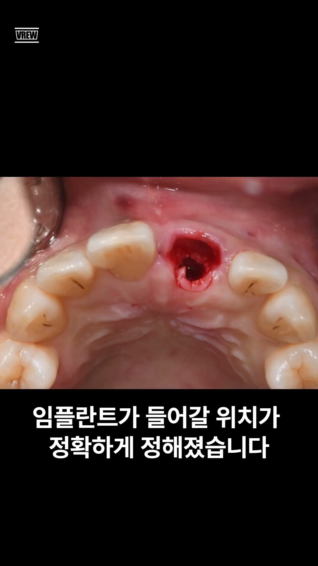 정체를 공개합니다