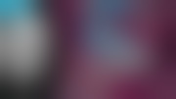 Lateral one-stage sinus lift with cerabone® and Jason® membrane – Dr. Massimo Frosecchi (Italy)