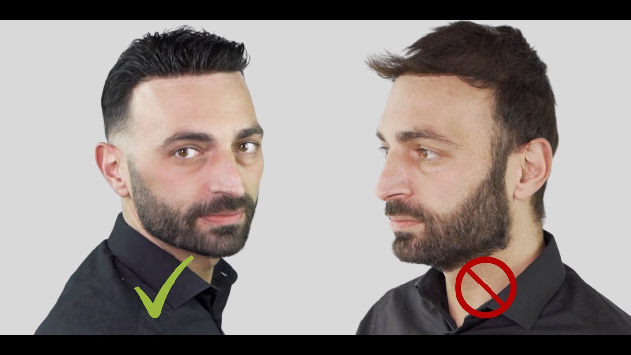 Ο Ανδρέας μας δείχνει τη διαφορά ενός Τουπέ από ένα Σύστημα Μαλλιών MACOhair®. Φοβερή Αλλαγή!