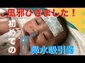 赤ちゃん初めての【風邪】で鼻水吸引器デビュー！！