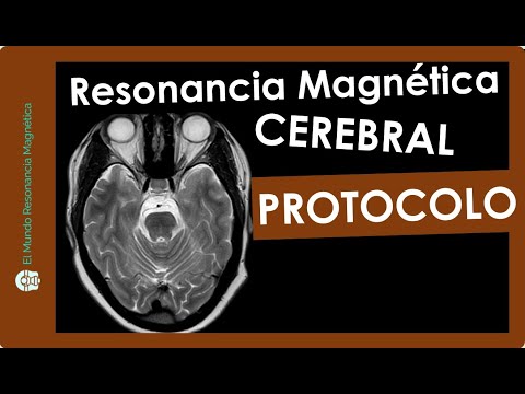 resonancia magnetica Resonancia Magnética
