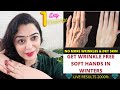 Winter Special-How To Make Your Hands Look 5 Years Younger! Wrinkle Free Smooth Hands| Pooja Luthra