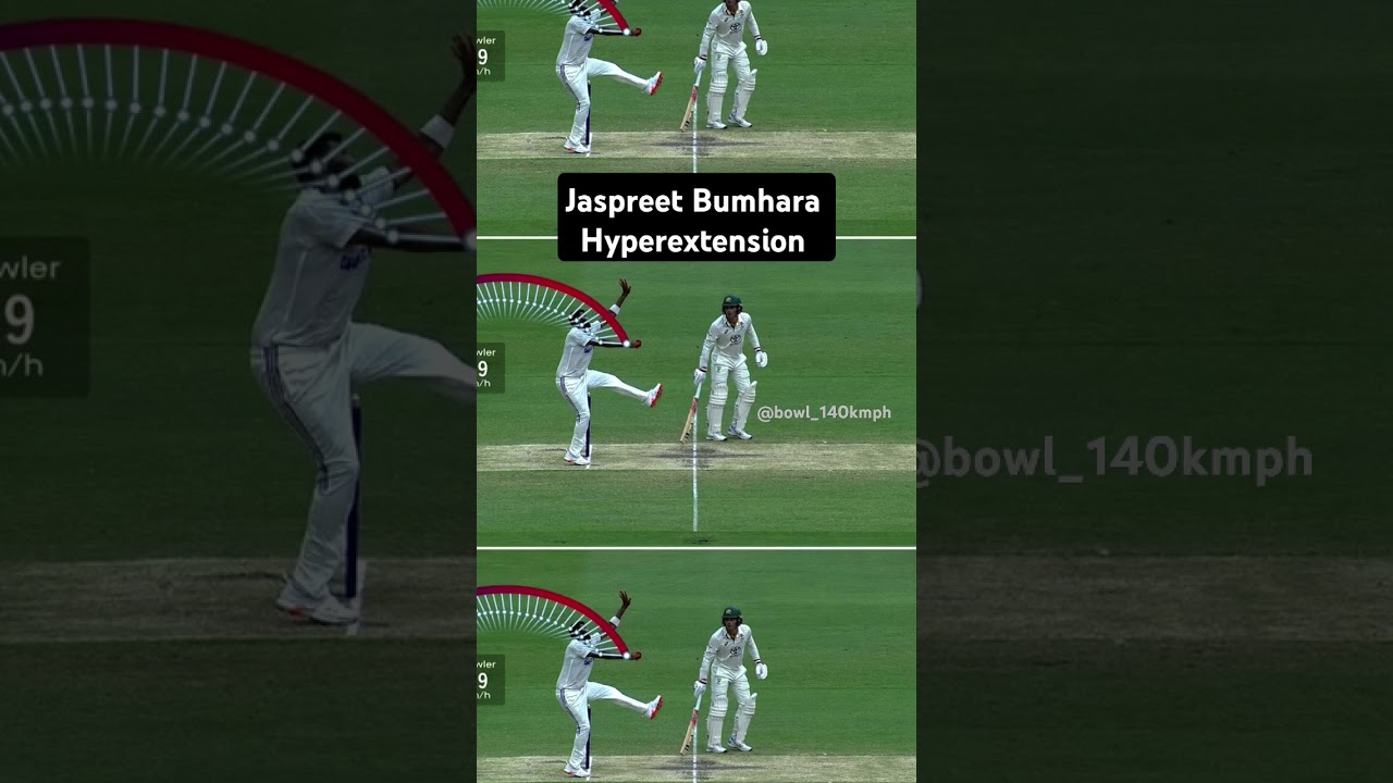 Jaspreet Bumhara uses more pace with Hyperextension in his bowling action 🔥#fastbowling#cricket#
