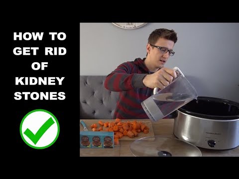 How to Get Rid of Kidney Stones!