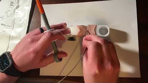 Mantis Closure Device