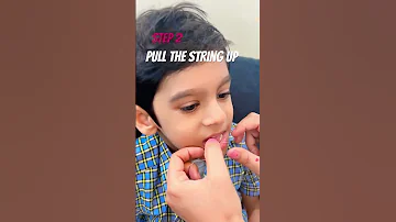 Easy 3 Steps How To Pull A Loose Tooth Pullout Tooth Loosetooth 
