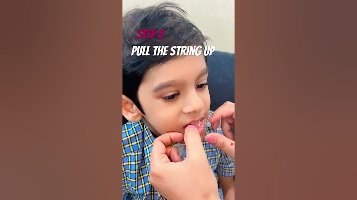 Easy 3 steps - how to pull a loose tooth | #pullout #tooth #loosetooth