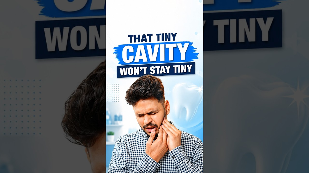 Tiny Cavity Today, Bigger Problem Tomorrow? 🦷 | Dental Filling Care in Bangalore