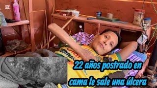 Esta grave don Carlos por una Úlcera en la espalda.