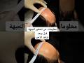 عملية تصغير الجبهة للمتعالجة قبل وبعد 
