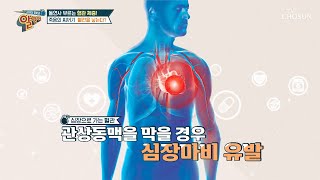 심장마비를 막고 혈관 건강관리의 핵심은 바로 혈전 제거 TV CHOSUN 20221016 방송  | [알맹이] 198회 | TV조선