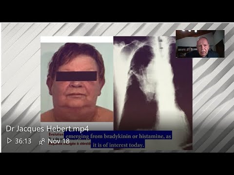 Vidéo: Sous-types Cliniques D'encéphalopathie Traumatique Chronique: Revue De La Littérature Et Proposition De Critères Diagnostiques De Recherche Pour Le Syndrome D'encéphalopa