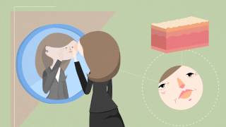 Video Introduction to MicroNeedling & Stem Cell Serums