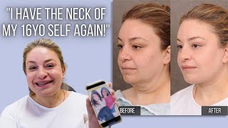Turning Back the Clock with AuraLyft: "I have a Neck of my 16 Year Old Self Again!" | Dr. Ben Talei