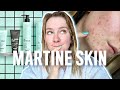 Je teste martine skin 100 honnte