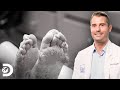 Homem com maior fungo no pé que o doutor Brad já viu | Meus Pés Estão Me Matando | Discovery Brasil