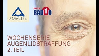 Augenlidstraffung Wochenserie Teil 2