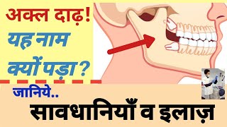 Pain after WISDOM TOOTH  removal | akal dant me dard ka ilaj | अक्ल दाढ़ निकालने के बाद सावधानियाँ ?