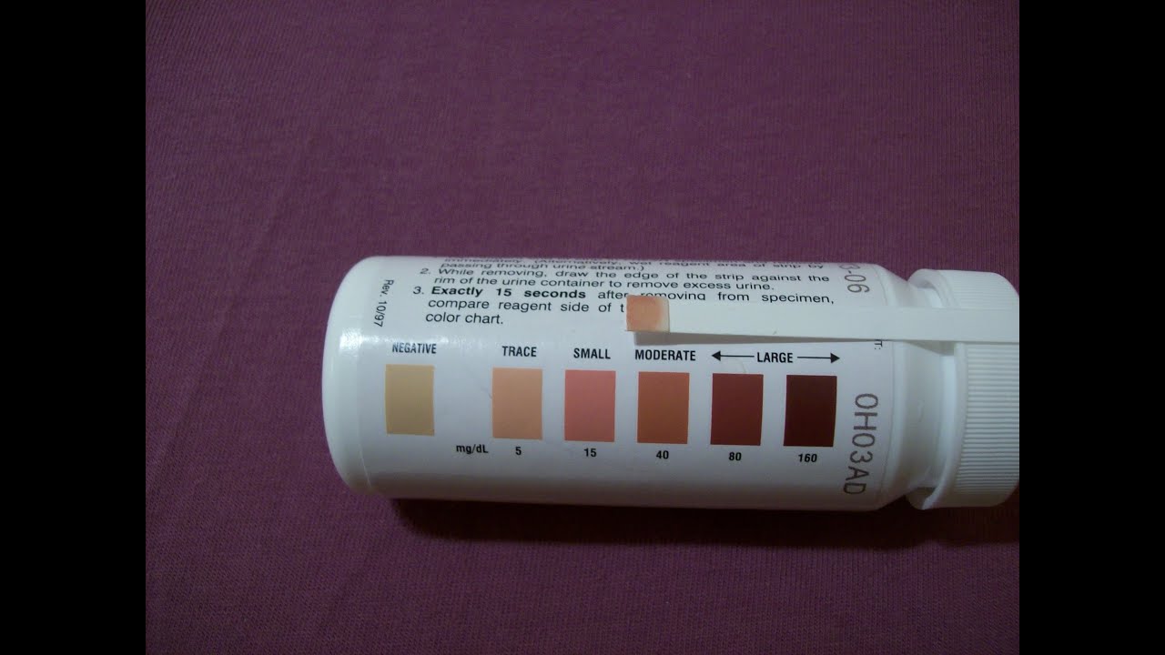 AMAZING DIETARY KETOSIS!! Coconut Oil Ketogenic Diet YouTube