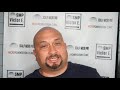 Scalp Micropigmentation