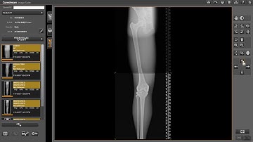 Image Suite Manual Stitching of Images.