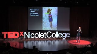 Invisible Disabilities | Amber Hammond | TEDxNicoletCollege
