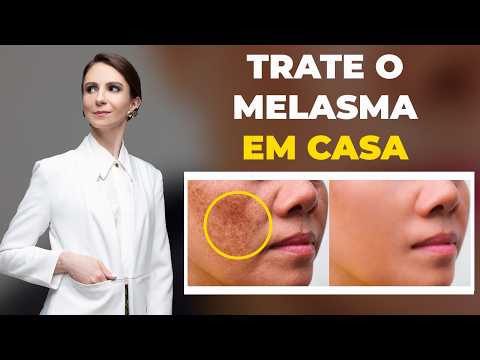 O que você PRECISA saber sobre tratar o MELASMA em CASA da maneira CERTA!