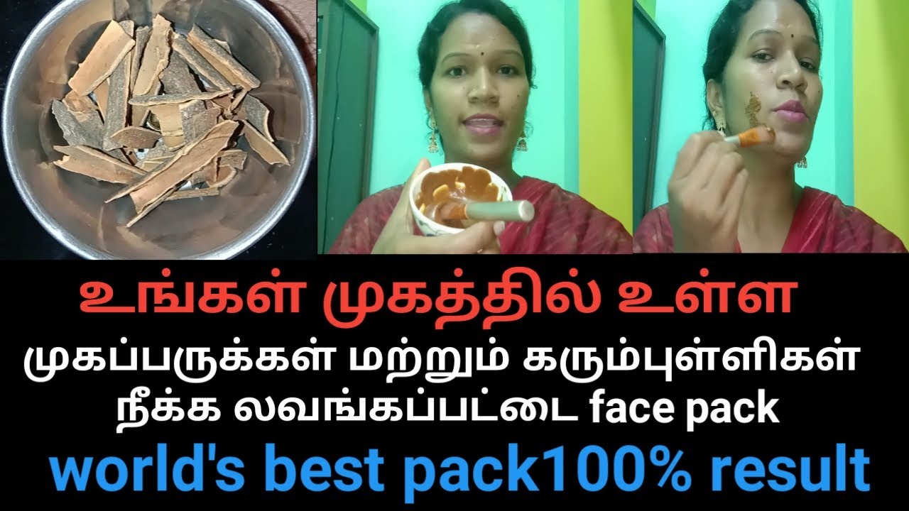 World best லவங்கப்பட்டை face pack / cinnamon remove acne & dark Spots