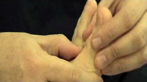 ¿Cuál es la causa de que el dedo gordo del pie se curve hacia dentro?