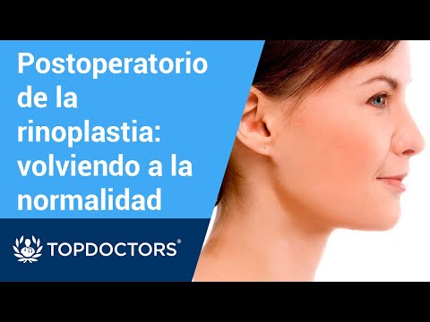 Video: Dormí Bien: Mandy Moore Y La Rinoplastia