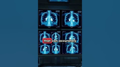 Unsupervised Meta-Learning for Few-Shot Image Classification