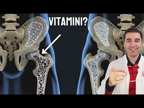 Video: Možete li obnoviti gustoću kostiju?