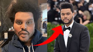 The Weeknd shocked fans after ‘plastic surgery’