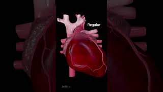 Heart Arrhythmias: Different Types and Symptoms screenshot 2