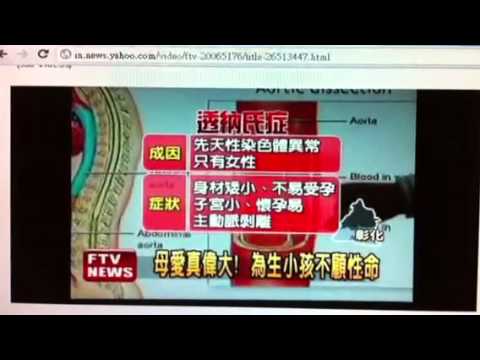 電視報導：博元婦產科試管嬰兒成功！恭喜
