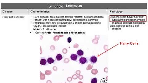 USMLE® Step 1 High Yield: Oncology: Leukemia