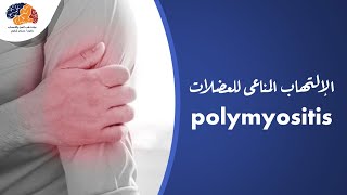 الإلتهاب المناعى للعضلات   #polymyositis