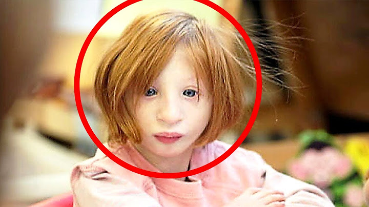 Nikdo si nechtěl adoptovat tuhle holčičku. O 19 let později vypadá úplně jinak...