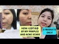 HOW I GOT RID OF MY PIMPLES (3 PRODUCTS ONLY) 2019 | Nicole Caluag
