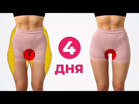 How to REDUCE "HIPS" in 7 DAYS - Fire Workout at Home For Legs