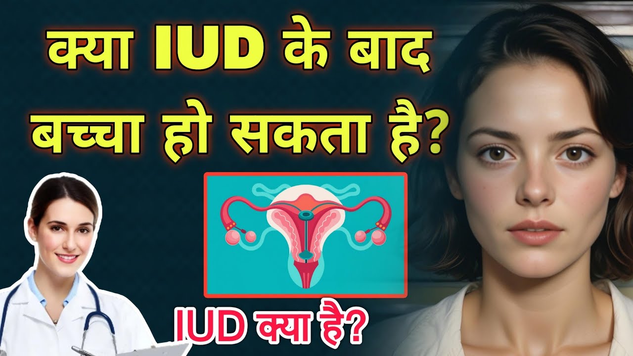 क्या IUD के बाद बच्चा हो सकता है? IUD KYA HAI , COPPER T YouTube